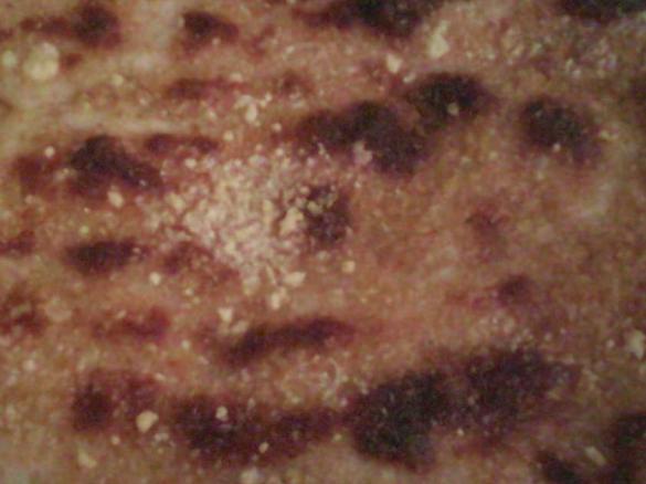 tortino patate e stracchino