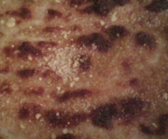 tortino patate e stracchino