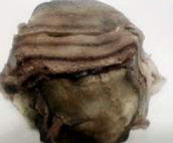 timballini di melanzane vegetali con piselli