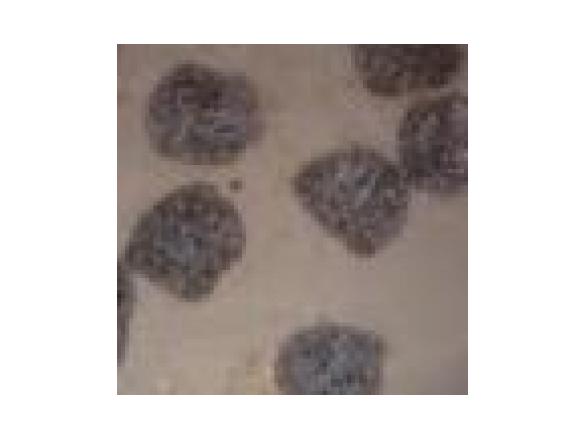 tartufi cacao e cocco